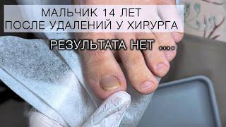 ПОЧЕМУ УДАЛЯЮТ НОГТИ? Посмотри сам и ПОКАЖИ РОДИТЕЛЯМ !#аленалаврентьева #подолог #подология