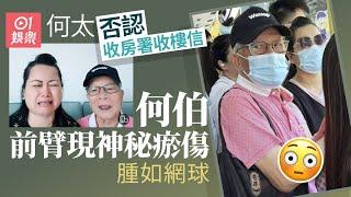 何伯前臂現神秘瘀傷腫如網球　何太否認收房署收樓信｜01娛樂｜何伯何太｜東張西望｜河馬｜忘年戀