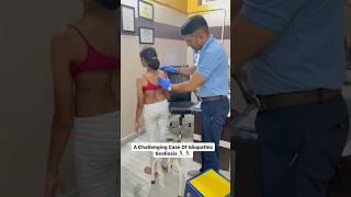 Challenging idiopathic scoliosis case treatment by DrRavi #scoliosis #chiropractic #reels #spine