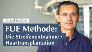 FUT Methode: Die Streifenentnahme / Haartransplantation