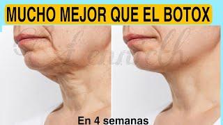 REJUVENECE 10 AÑOS. MEJOR que el BOTOXRejuvenece, Reafirma, Quita MANCHAS/FLACIDEZ en el CUELLO