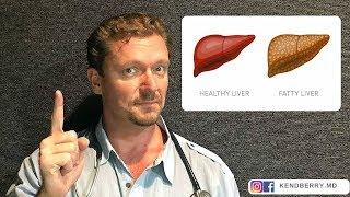  STOP These 5 Things to Reverse Fatty Liver (Update 2024) 