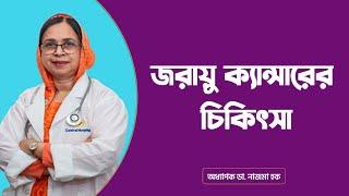 জরায়ু ক্যান্সারের চিকিৎসা | Cervical Cancer Treatment
