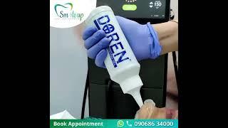 Chin Laser Hair Removal at smile up clinic #ytshorts #youtubeshorts #laser #trendingshorts