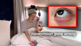 Got a Nasty Eye Infection during Romantic Honey Moon