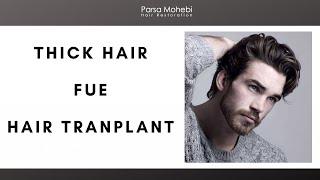 Hair Transplant for Thick Hair (FUE with Dr. Parsa Mohebi)