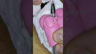 Finger in epoxy resin