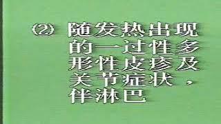 卫生部医学视听教材—儿科—EK045 幼年类风湿病的诊断和治疗