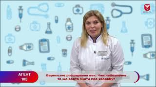 АГЕНТ 103: Варикозне розширення вен: чим небезпечне та що варто знати про хворобу?