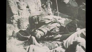 Photos of Death During World War 1 (1914-1917)