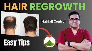 Guaranteed Hair Regrowth Tips by Dr. Vikram | #hairregrowth #hairfall