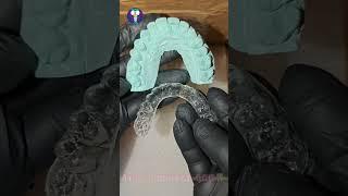 ‍Perfect Fit Make Perfect Smile| Upper Splint | Tamil Dental Lab | #artandcraft #invisible #art