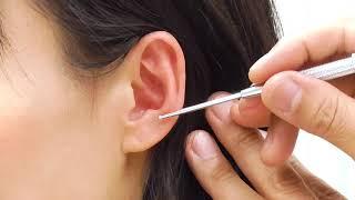 Dr.Ma's ear acupuncture points