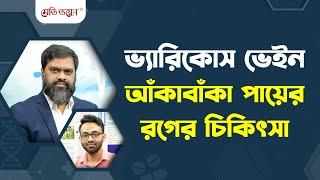 ভ্যারিকোস ভেইন: আঁকাবাঁকা পায়ের রগের চিকিৎসা | Dr. AKM Ziaul Haque | স্বাস্থ্য কথন | পর্ব-৫৮