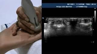 SONOWORLD   How To  Hand   Wrist Sandra J  Allison, MD