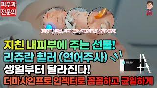 리쥬란힐러 연어주사 스킨부스터 더마샤인프로 인젝터주사 LDM 연예인필 보습 모공 탄력 잔주름 안티에이징 피부톤 개선 (피부과전문의 피부맨)