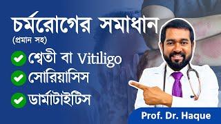 জটিল চর্মরোগ গুলোর পরীক্ষিত সমাধানঃ শ্বেতী, সোরিয়াসিস, ডার্মাটাইটিস | Dr. Haque (চিকিৎসক, আমেরিকা)