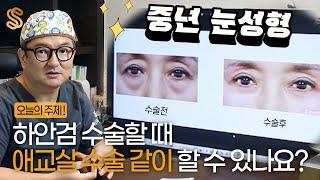 중년 하안검수술 할 때 애교살 수술 같이 할 수 있나요? #중년눈성형 #하안검수술