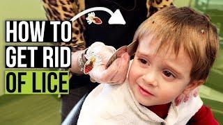 Head Lice Combing Techniques - How to Check for Lice at Home