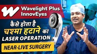 Near Live Surgery | World's First AI-based Laser Specs Removal Tech - Wavelight Plus InnovEyes