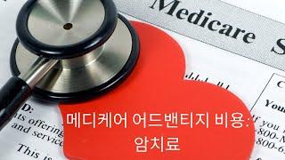 메디케어 어드밴티지 플랜으로 보는 의료 서비스 비용 | 암치료