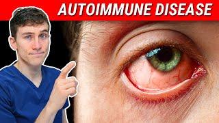 The SHOCKING Truth about Autoimmune Disease and Eye Health