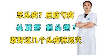 总头疼？后脑勺疼、头顶疼、偏头疼？收好这几个头疼特效穴！