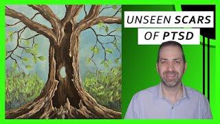 Beyond FLASHBACKS: The Emotional Impact of PTSD | Dr. Rami Nader