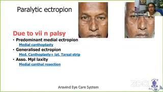 AIOS ARC. PG Update Series on Taking you Forward in Oculoplasty-Dr.Usha Kim