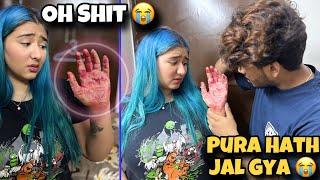 Girlfriend Ka Pura Haath Jál Gaya  Every One Started Crying 