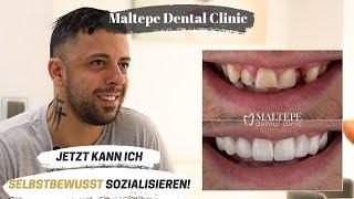 Lächeln Sie Selbstbewusst Mit Zirkonkronen | Maltepe Dental Clinic, Istanbul / Türkei