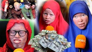 Soomali Albino boqolaal dollar oo kadis ah ayan siiyay lakiin isku qabiil miyaa kuwa noocaan ah ee..