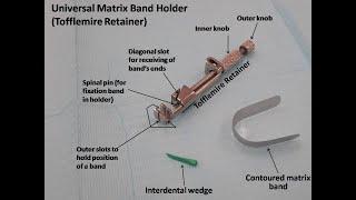 Placement of Universal Matrix Band Holder (Tofflemire Retainer)