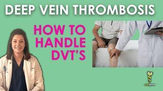 Deep Vein Thrombosis (How to handle DVT's)