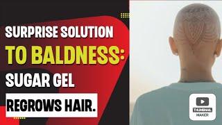 Surprise Solution to Baldness: Sugar Gel Regrows Hair.