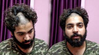 I accidentally shaved my HEAD | Suri Sahab