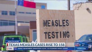 Texas measles cases rise to 158