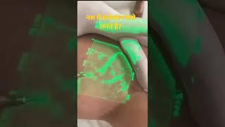 नस में सुई कैसे लगते हैं।। #shorts #biology #youtubeshorts #aj22 #shortsvideo #experiment