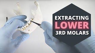 How To Extract Erupted Lower Third Molars | OnlineExodontia.com