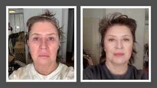 Tretinoin application - the best tips and tricks / Dr. Bärbel Schäfer