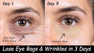 Remove Under Eye Wrinkles , Puffy Eyes & Dark Circles & Under eye cream  for dark circles &Wrinkle