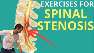 Spinal Stenosis: 5 Exercises for Low Back Pain Relief | Aleks Physio