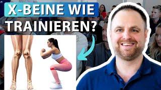 X-Beine wegtrainieren oder korrigieren? (Alles zu Ursachen, Symptomen & Training)