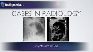 Cases in Radiology: Episode 6 (abdominal emergency, x-ray, CT)