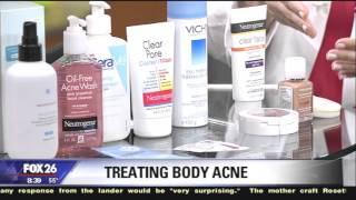 Dr. Sherry Ingraham on Treating Body Acne  (Bacne)