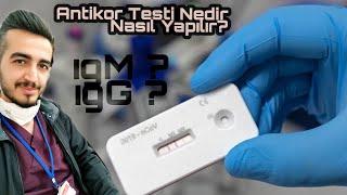 Antikor testi nedir nasıl yapılır ?