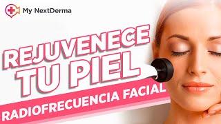 RADIOFRECUENCIA FACIAL ¿Qué es y cuáles son sus beneficios?