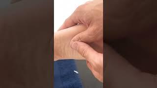 FREE COURSE: Trigger Point Therapy #triggerpointtherapy #manualtherapy #osteopathy