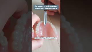 Как уходит кость челюсти? #безнёбасъёмныепротезы #протезирование #съёмныепротезы #зубныепротезы