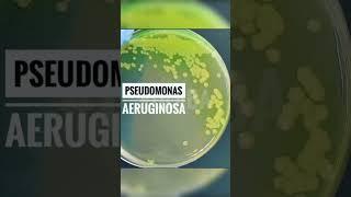 E.coli, Pseudomonas aeruginosa , Staphylococcus aureus #medical #microbiology @medicoshots ️